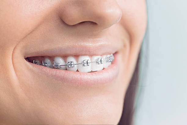 Dental Inlays and Onlays in Sperry, OK